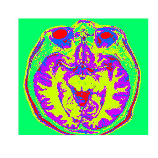 plot of chunk unnamed-chunk-5