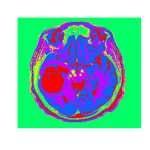 plot of chunk unnamed-chunk-6